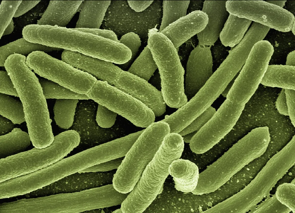 koli bacteria, escherichia coli, bacteria, disease, pathogens, microscopy, electron microscopy, electron microscope, vaccination, immune system, diseases, vacci